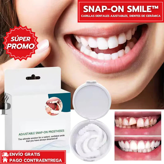 Snap-On Smile™: Carillas Dentales Ajustables - Dientes de Cerámica